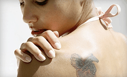 Start The New Year Fresh With Tattoo Removal - DermMedica