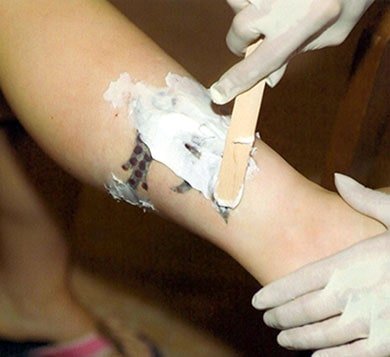 Tattoo Removal Cream: The Future of Tattoo Removal?